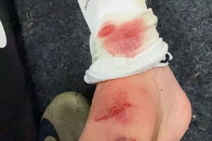 记者晒李帅脚部伤口照：李帅狠人打满全场，这一下甚至没吹犯规