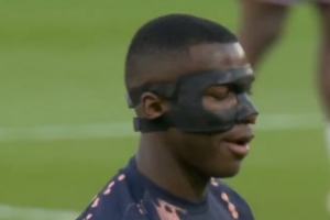 记者：凯塞多对阵纽卡时面部受到轻微撞击，因此本场带面具出战